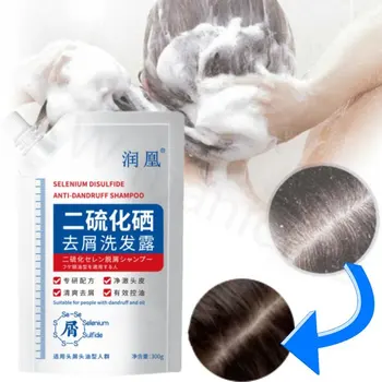300ml Selenyum Disülfür kepek Önleyici Antipruritik Kontrol Kafa Sorunu Yağı Derin Temizlik Kafa Derisi Besleyici Saç Torbalı Şampuan